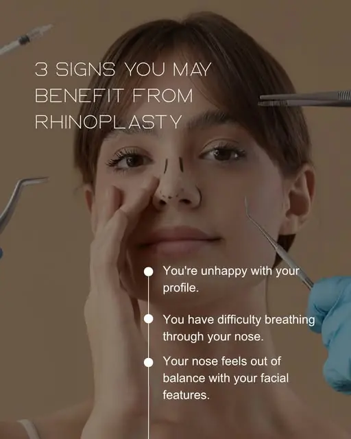 An Instagram card listing three reasons people ask about rhinoplasty: the profile, difficulty breathing through the nose, and a nose that feels out of balance with the other features.