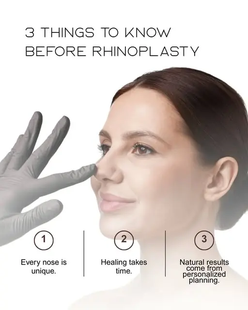 An Instagram card listing three things to know before rhinoplasty: every nose is unique, healing takes time, and results come from planning for the individual face.