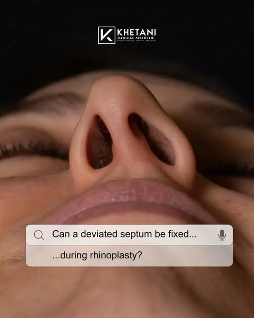 An Instagram card showing the base of a nose beside the question, can a deviated septum be fixed during rhinoplasty.