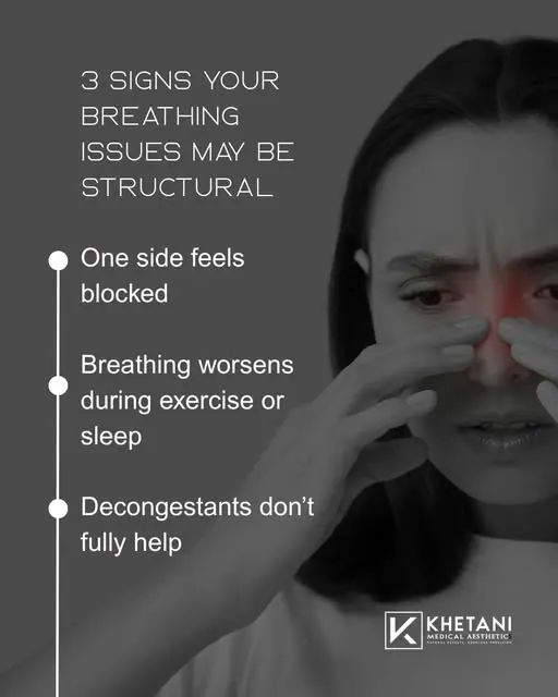 An Instagram card listing three signs that breathing difficulty may be structural: one side feels blocked, breathing worsens during exercise or sleep, and decongestants do not fully help.